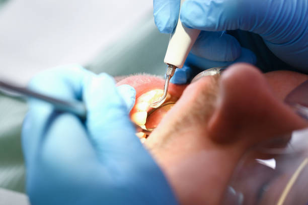Best Emergency Dental Services for Seniors in Jal, NM